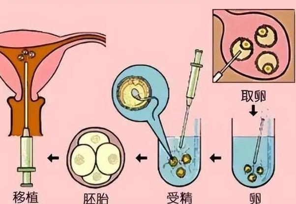 供卵试管是自己的孩子吗【供卵试管:孩子的真正亲生母亲是自己吗?】