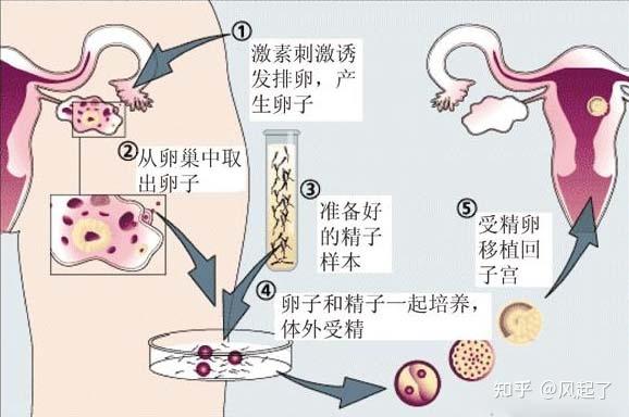 供卵的卵子来源是哪里来的(卵子供应链：供卵的卵子来源是哪里来的？)