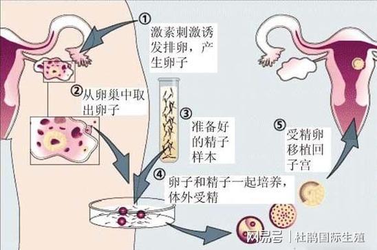 供卵的孩子跟母体有血缘关系吗【供卵孩子与母体是否有血缘关系？】